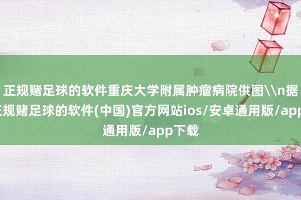 正规赌足球的软件重庆大学附属肿瘤病院供图\n据悉-正规赌足球的软件(中国)官方网站ios/安卓通用版/app下载